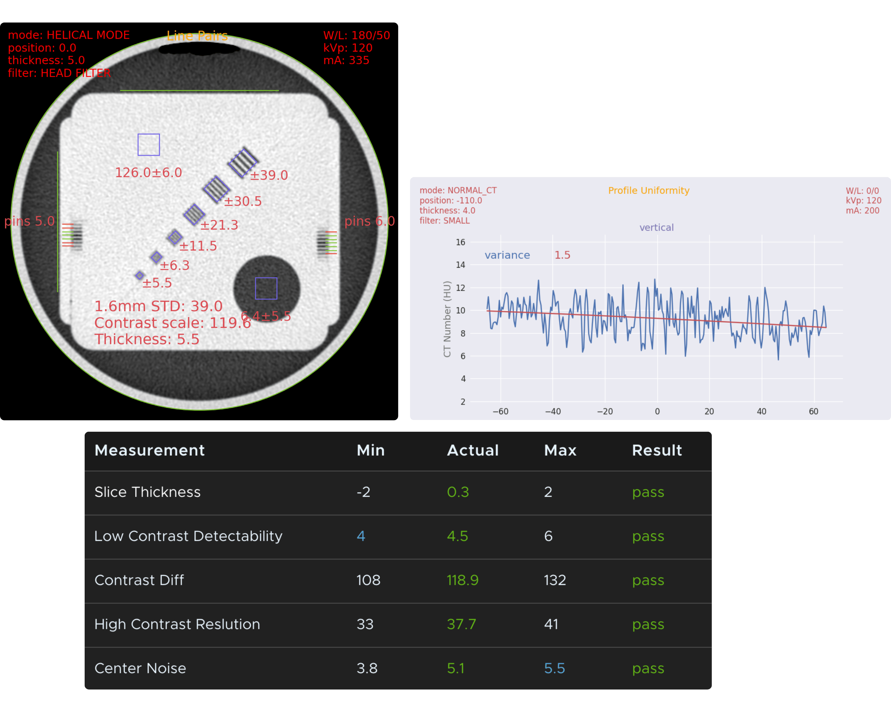 measurements taken from a phantom image